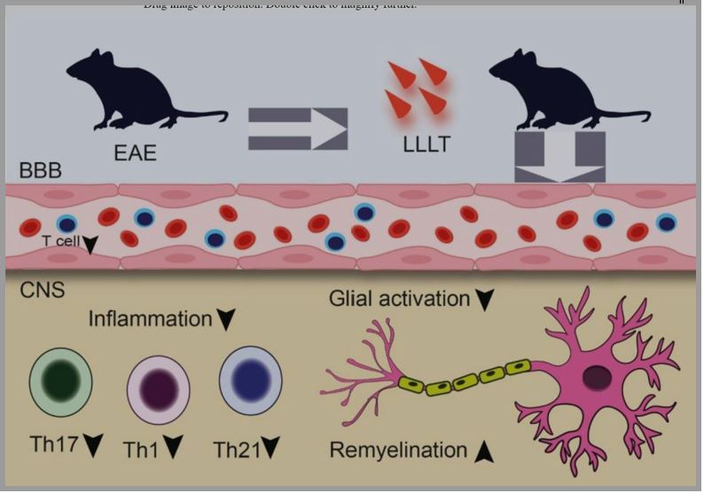 نور درمانی برms