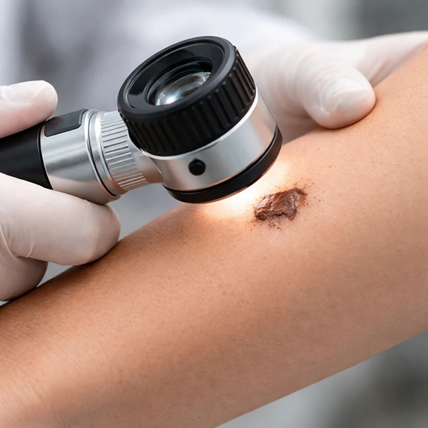 تشخیص پیشرفته بیماری‌های رنگدانه‌ای با دستگاه لامپ وود