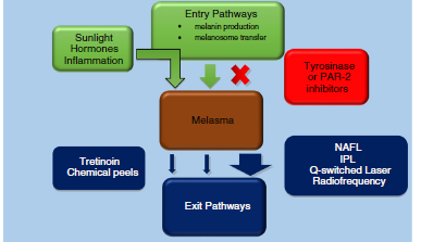 بررسی درمان ملاسما با لیزر و نوردرمانی