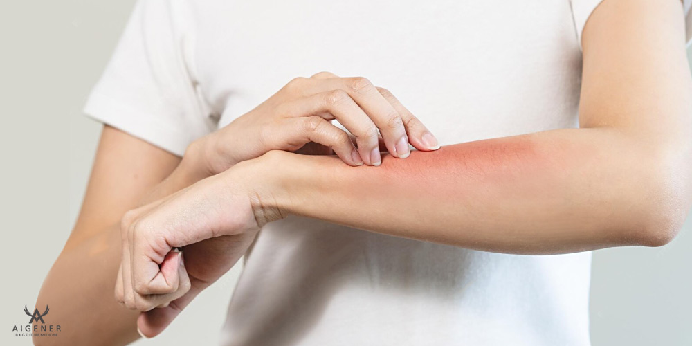 درماتیت و روش‌های درمان